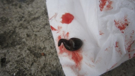 Donating blood to this little sucker